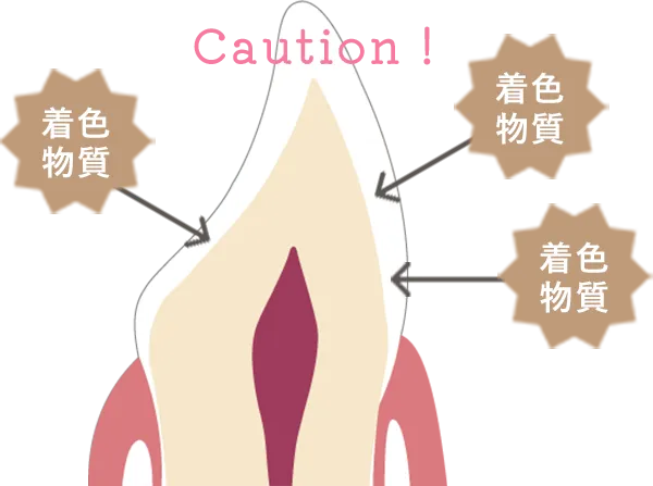 ホワイトニング直後の歯
